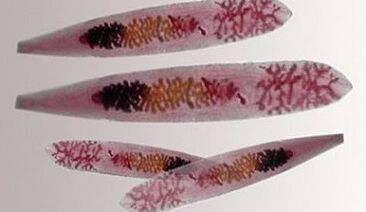 Opisthorchis parasitos no corpo humano