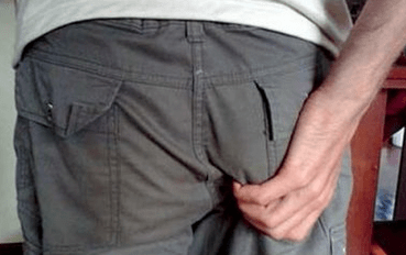coceira no ano como síntoma da presenza de parasitos