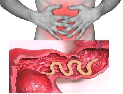 os signos de helmintiase crónica son trastorno dispéptico do intestino