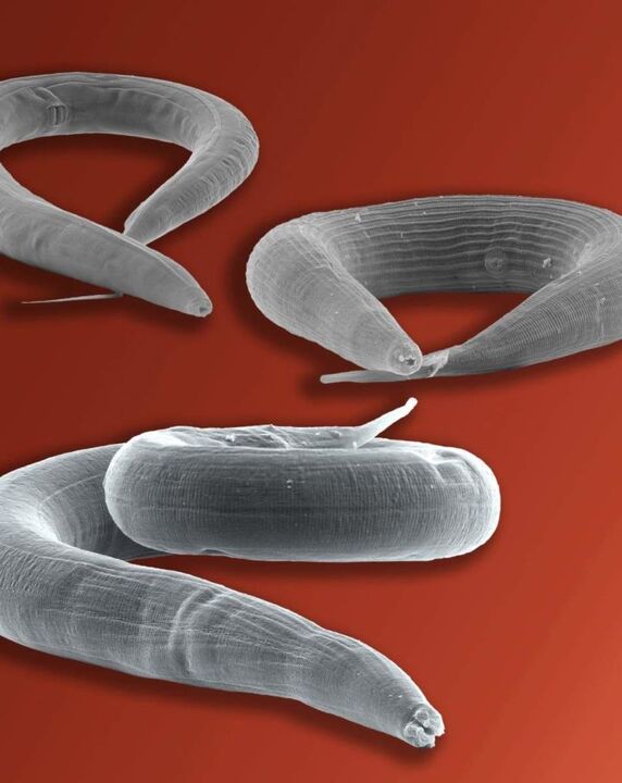 parasito de oxiuro que vive no intestino