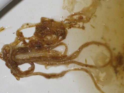 vermes parasitos do corpo humano