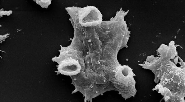 Negleria fowlera é un protozoo parasito perigoso para a vida humana. 