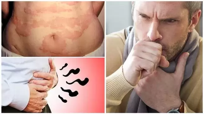 As alerxias, a tose e o inchazo son signos de dano ao corpo por vermes