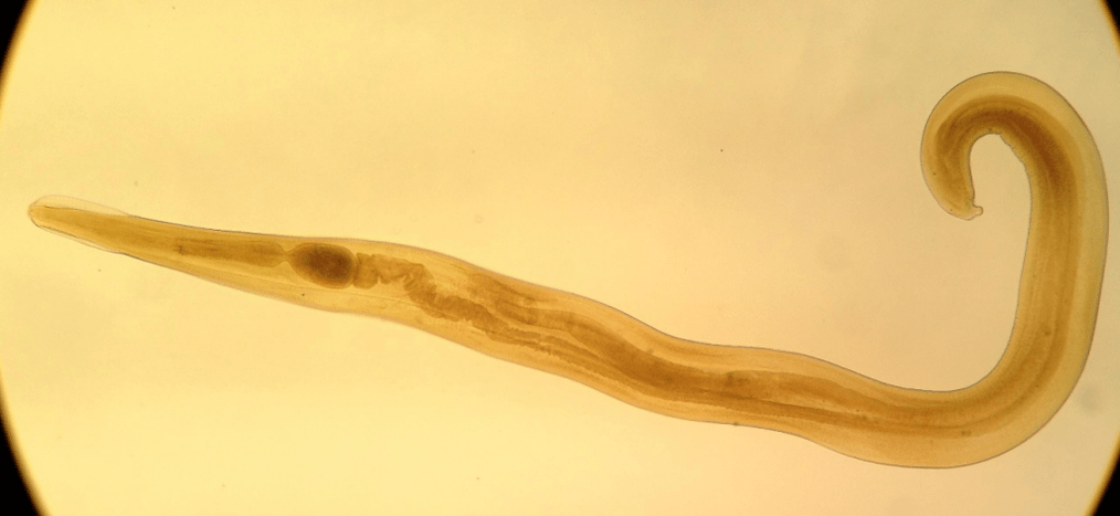 O pinworm é un parasito común entre os nenos. 