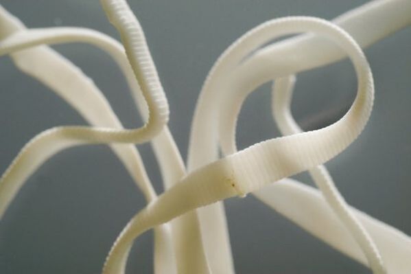 Ascaris é un nematodo, pertence á orde dos vermes redondos
